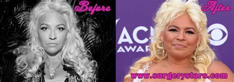 beth chapman plastic surgery before and after pic plastic surgery surgery chapman