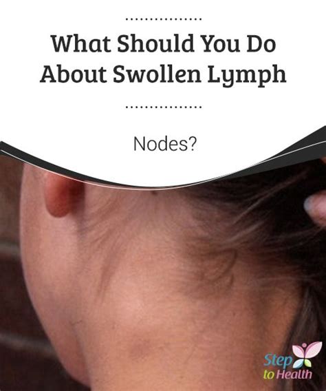 What Should You Do About Swollen Lymph Nodes Swollen Lymph Nodes