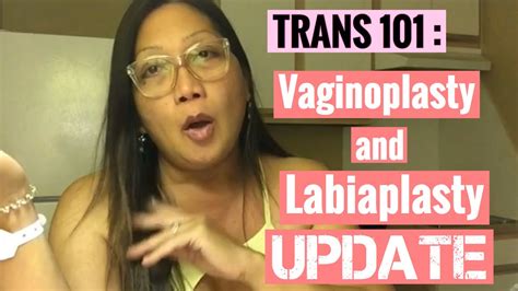 My Vaginoplasty Labiaplasty Updates Srs Mtf Transgender Youtube