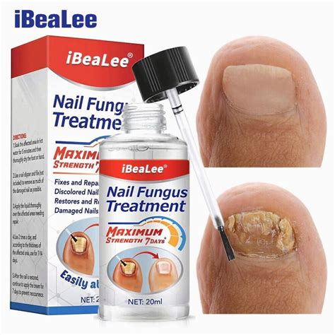 Ibealee Nail Fungus Treatment 7days Extra Strong Repair Essence Serum