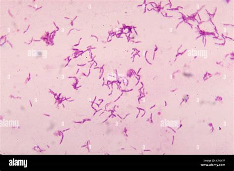 Bifidobacterium Bacteria High Resolution Stock Photography And Images
