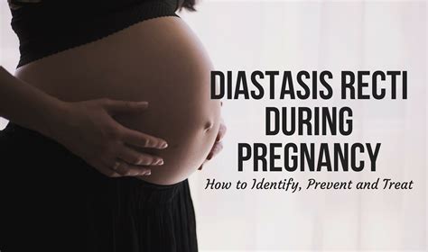 That's when i realized i had diastasis recti, or abdominal separation. Diastasis Recti During Pregnancy: How to Identify, Prevent ...