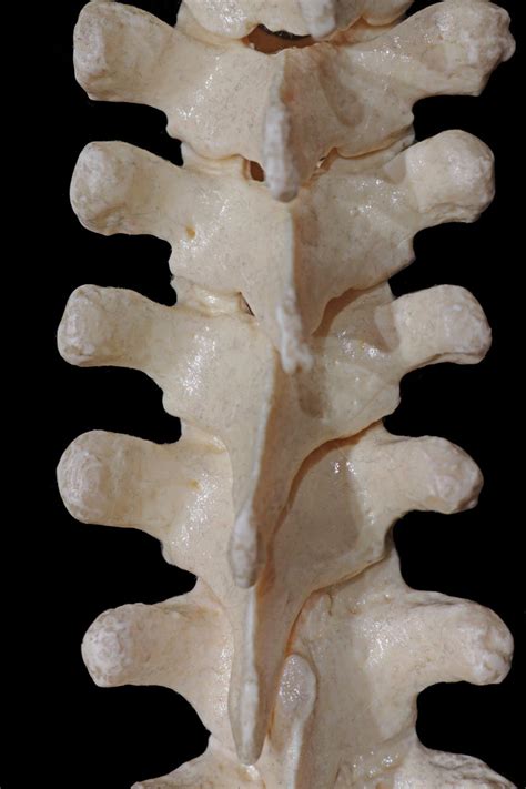 Posterior View Of The Thoracic Spine Neuroanatomy The Neurosurgical