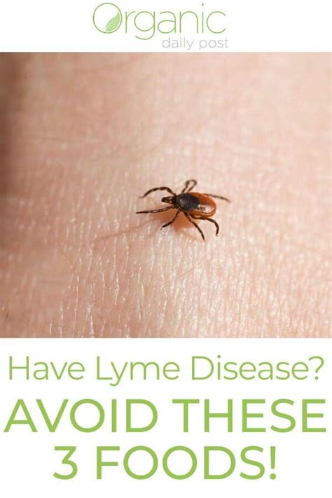 Have Lyme Avoid These 3 Foods Natural Cough Remedies Herbal Cure