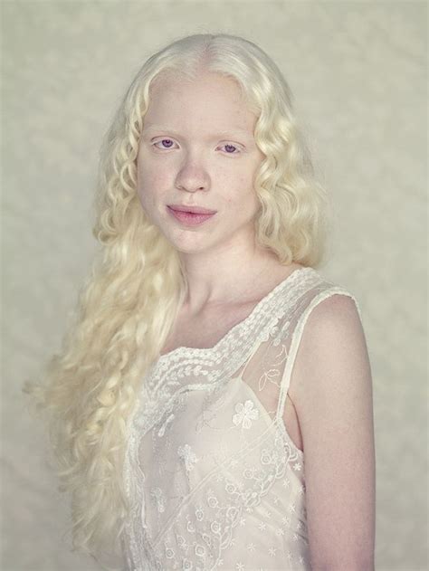 Albinism Albinism Beauty Pale Beauty
