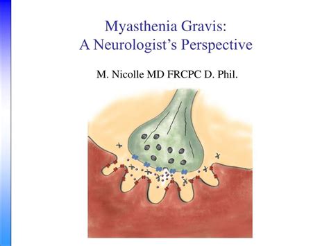 Ppt Myasthenia Gravis A Neurologists Perspective Powerpoint