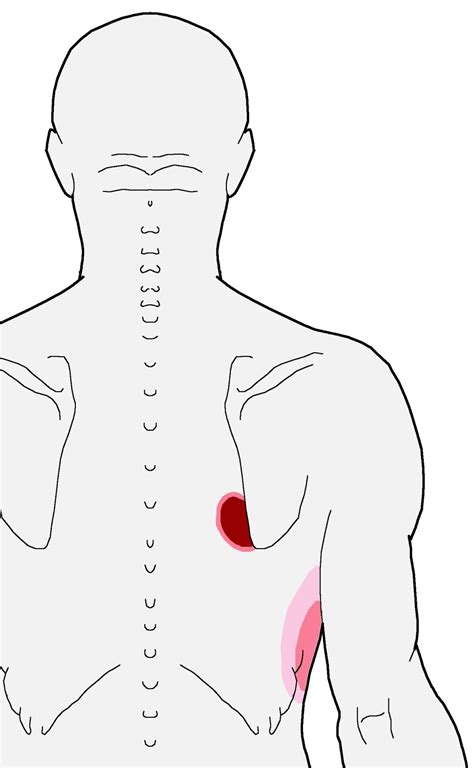 Trigger Points Nagging Pain Inside The Bottom Of The Shoulder Blade