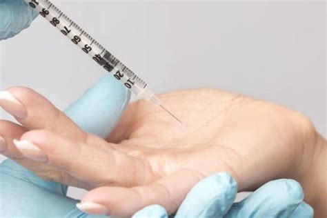 Botox® And Dysport For Palmar Hyperhidrosis Body Renewal Clinics