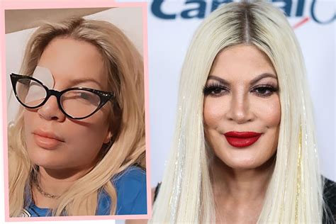 Tori Spelling Left Contact Lenses In For WEEKS Now She Has A Scary Eye Injury Perez Hilton