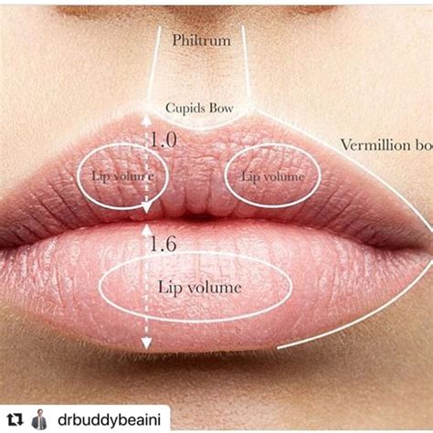 Dr Buddy Paul Beaini On Instagram “perfect Lips Augmentation Dermal