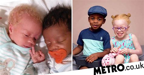 Mum Of Black And White Twins Say People Do Not Believe