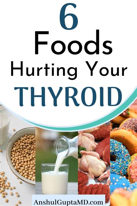 Understand The Correlation Between Food And Thyroid Disorder List Of