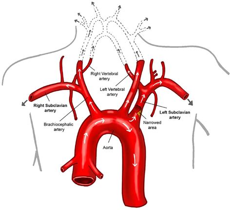 Branches Of Subclavian Artery