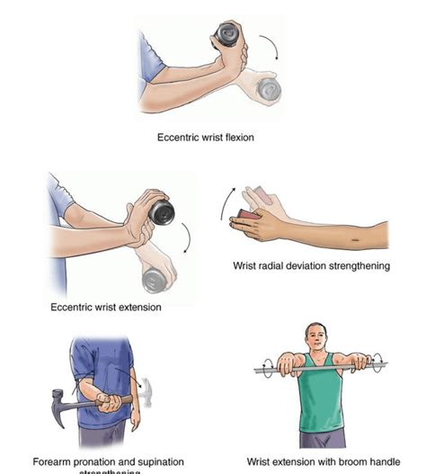 Elbow Exercises Gmphysio