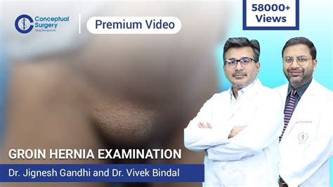 Groin Hernia Examination Dr Jignesh Gandhi And Dr Vivek Bindal Youtube
