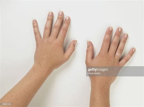 Pair Of Tanned Hands Palms Down Showing Pale Skin On Ring Finger Photo