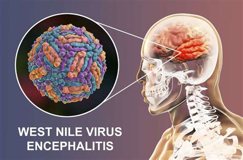 Wie Gefährlich Ist Das West Nil Virus