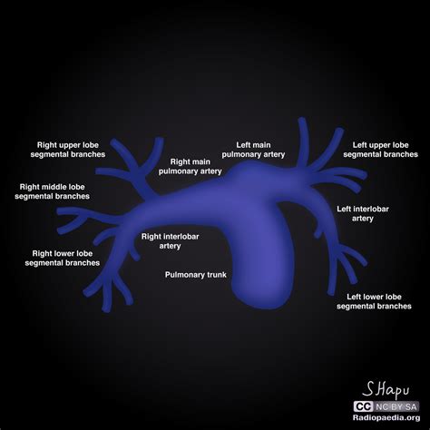 Arteries Diagram A Level A Photograph Showing Distribution Of