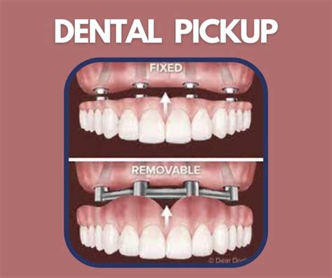 Fixed Vs Removable Dentures Which One Is Better