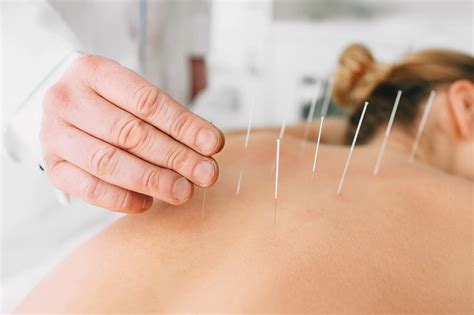 effective dry needling melbourne