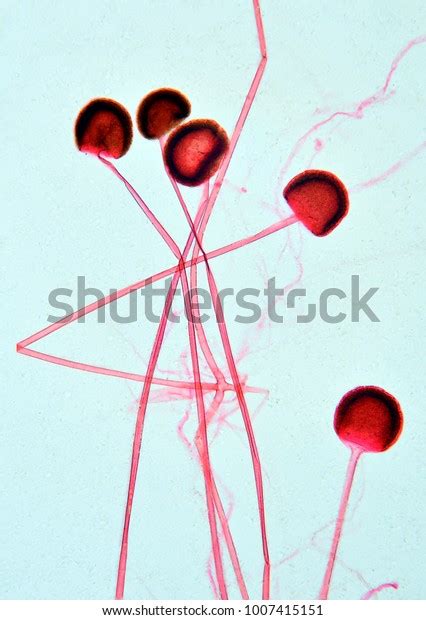 Rhizopus Sporangia Under Microscope Stock Photo 1007415151 Shutterstock