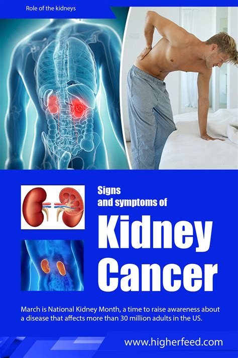 When a person has kidney cancer, it means that their kidney cells have become cancerous or malignant and have grown out of control thus forming a tumor. March is National Kidney Month, a time to raise awareness ...