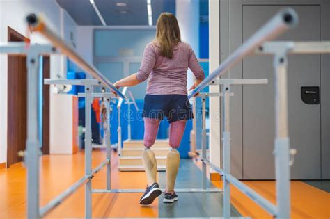 Young Woman With Prosthetic Legs Exercising At Physiotherapy Center