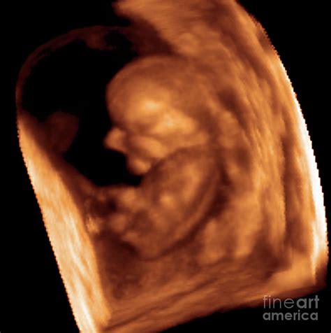 Foetus At 9 Weeks Photograph By Dr Najeeb Layyousscience Photo Library