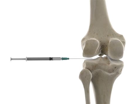 Injections For Knee Pain Melbourne Malvern And Werribee Moati