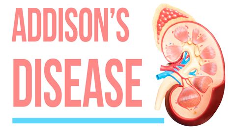 Addisons Disease Symptoms Diagnosis And Treatment Endocrinology
