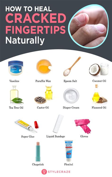 Natural Home Remedies For Cracked Fingertips Cracked Fingertips Dry