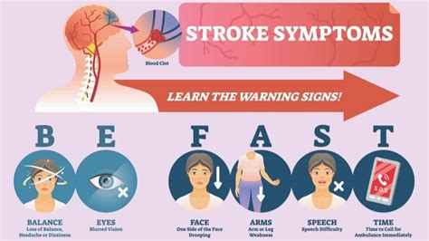 Stroke Types Symptoms And Long Term Outlook 1md Nutrition™
