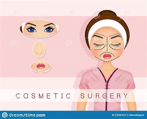 Illustration Of Cosmetic Surgery Stock Illustration Illustration Of