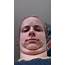 People Who Look Like Thumbs Do They Really Exist  By Adam Dachis