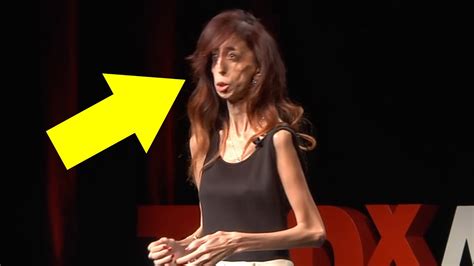 She Was Once Called The World’s Ugliest Woman—now She’s Living Your Dreams Youtube