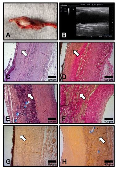 Polymers Free Full Text Tissue Engineered Carotid Artery