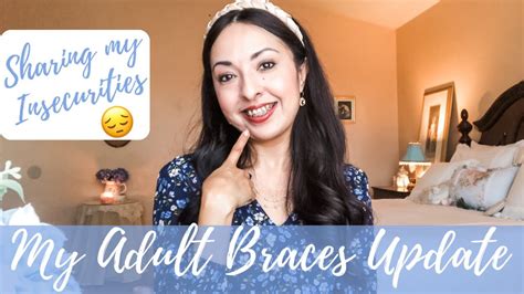My Adult Braces Update Two Months With Braces Sharing My
