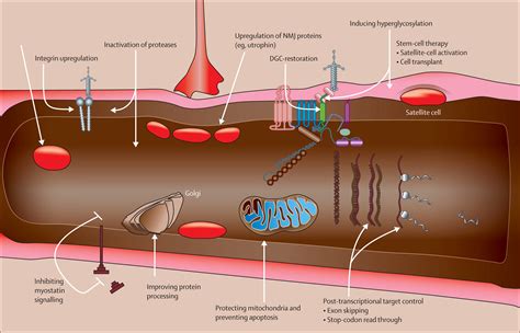 Interventions For Muscular Dystrophy Molecular Medicines Entering The