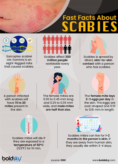 Scabies Causes Transmission Symptoms Diagnosis Treatment And