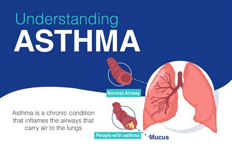 Overview Of Asthma Causes Symptomstypes Risk Factors And Its Treatment