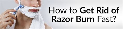 How To Get Rid Of Razor Burn Fast 11 Ways To Prevent And Treat Razor
