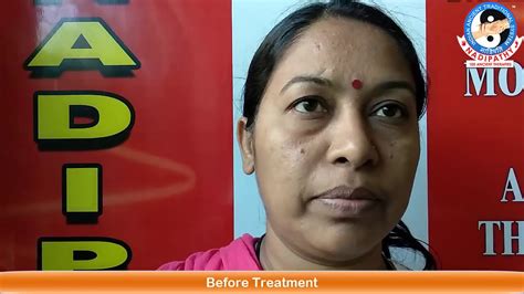 l4 l5 cured in only 7 sittings nadipathy youtube