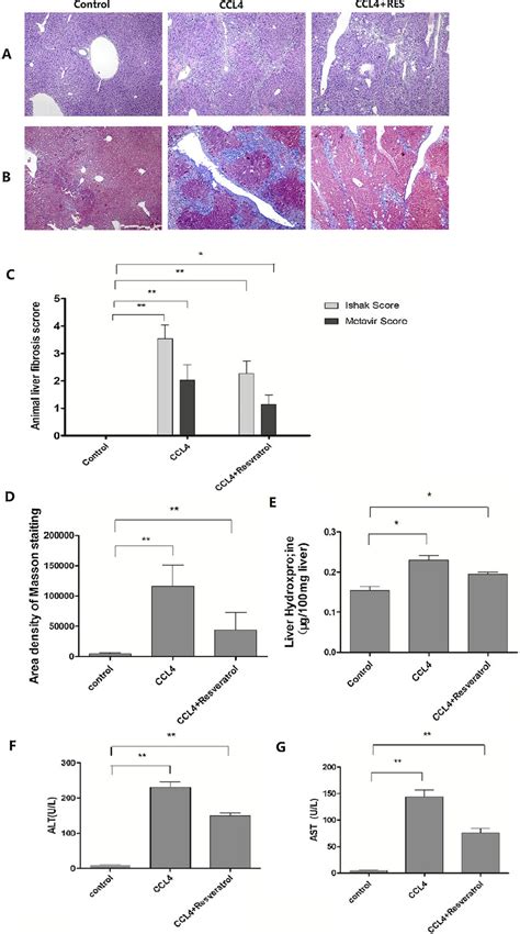 Resveratrol Relieved Ccl 4 Induced Liver Fibrosis In Mouse