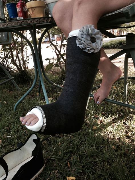 37 Best Casts And Foot Images On Pinterest Broken Leg Cast Art And