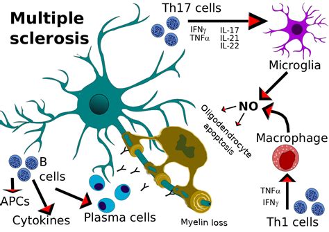 Overview Of Immunopathology In Multiple Sclerosis Scimeditor