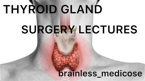 Thyroid Surgery Lecture Developmental Disorders Goiters Aetiology