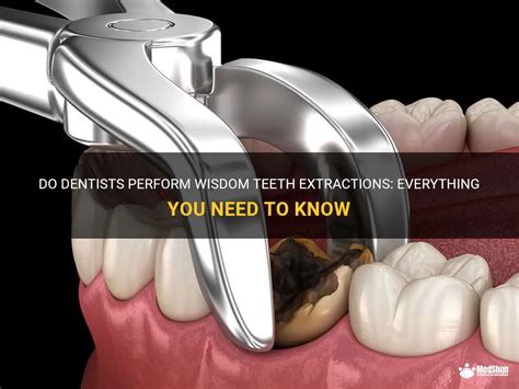 Do Dentists Perform Wisdom Teeth Extractions Everything You Need To