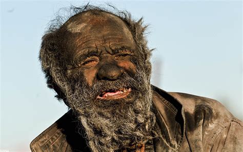 This Man Didnt Shower For 60 Years What It Did To His Face Omg