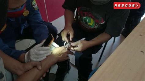 Evakuasi Cincin Di Jari Sempit Oleh Team Rescue Disdamkar Kabbekasi