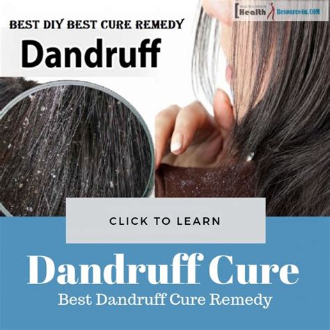 Best Dandruff Cure Remedy And Control Treatment